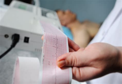 bad ekg readings|8 Reasons Why Your EKG Reading Could be Abnormal.